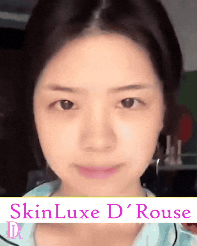 SkinLuxe